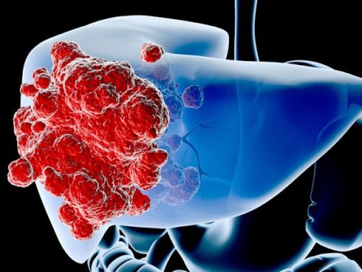 ảnh hưởng nghiêm trọng đến sức khỏe con người.