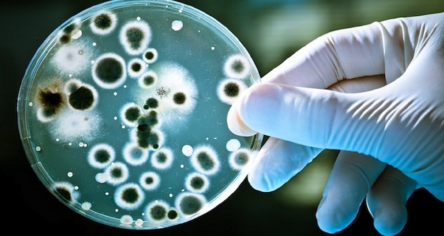 vi khuẩn ecoli trong nước