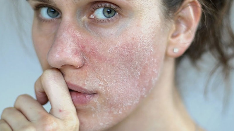 tam_quan_trong_cua_viec_bo_sung_nuoc_doi_voi_lan_da_2